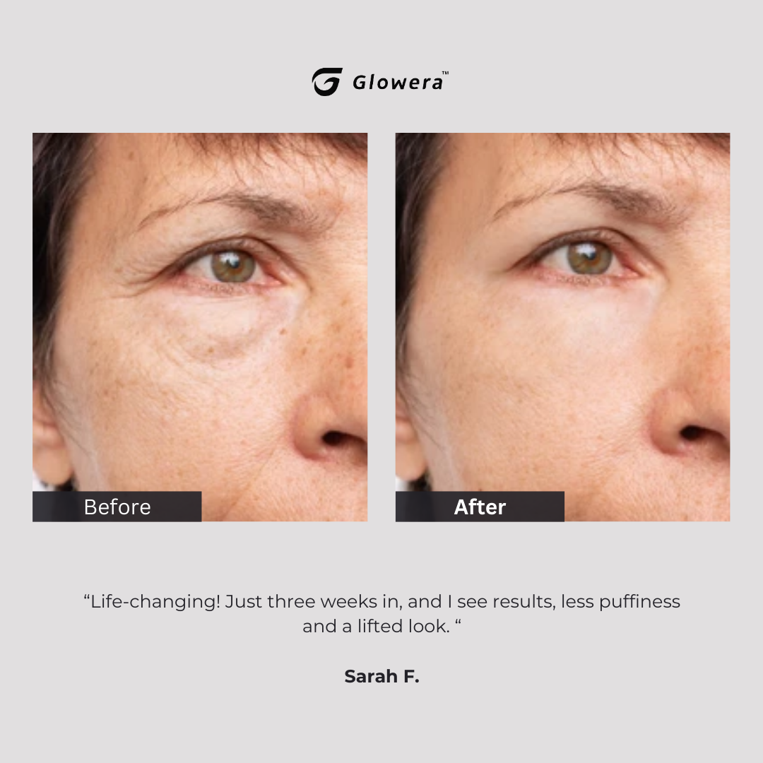 Glowera™ Red Light Therapy Mask